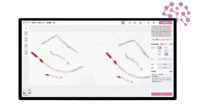 Thorough Copilot 正式發布——引領病理邁向智能化交互時代
